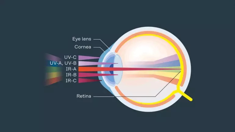 pw-press-augen-verblitzt-teaser-en-169